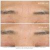 Dior Capture Totale Hyalushot Concentré 15 ml thumbnail