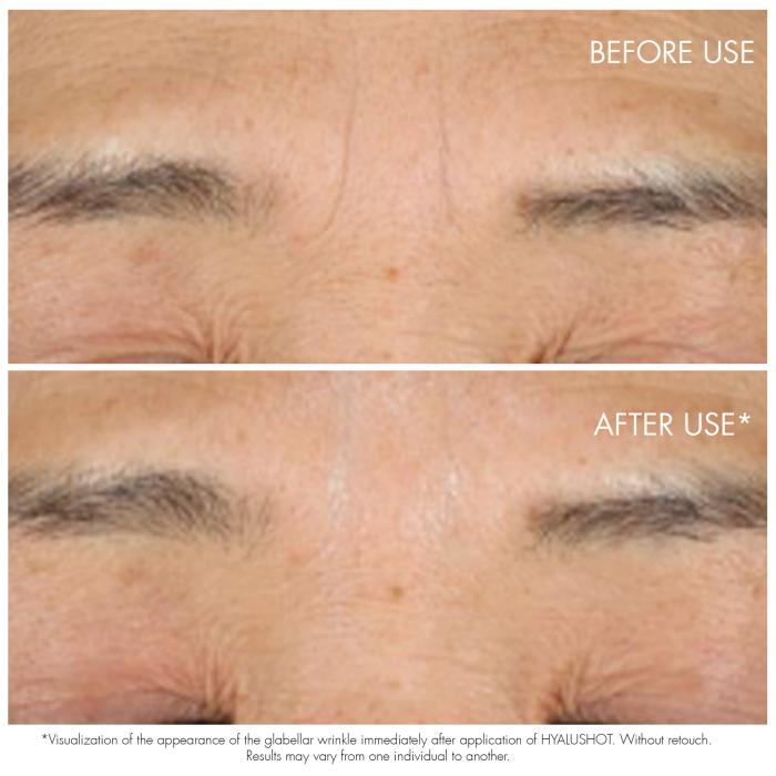 Dior Capture Totale Hyalushot
