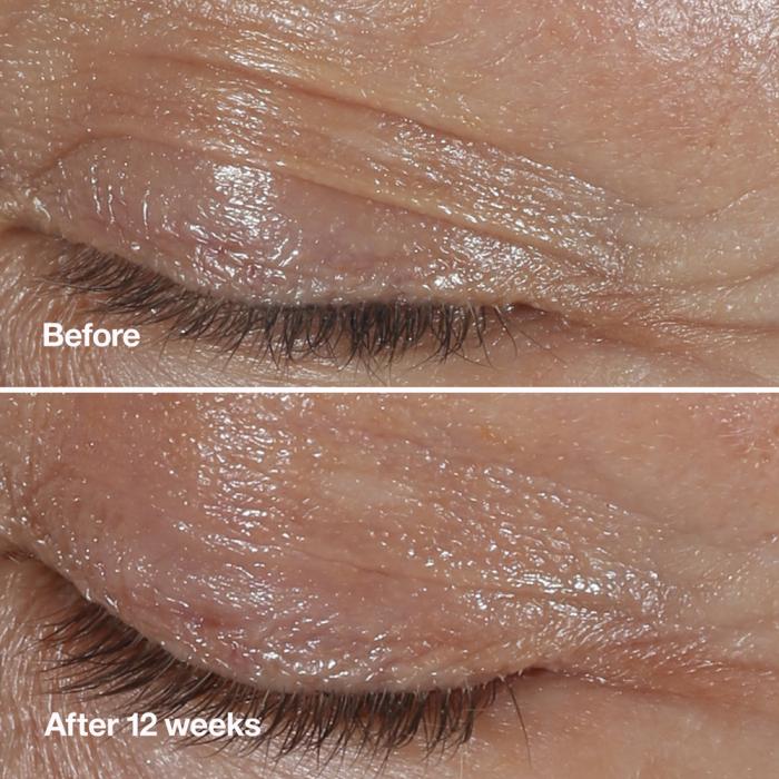 Clinique Smart Clinical Repair Wrinkle Eye Cream 15 ml